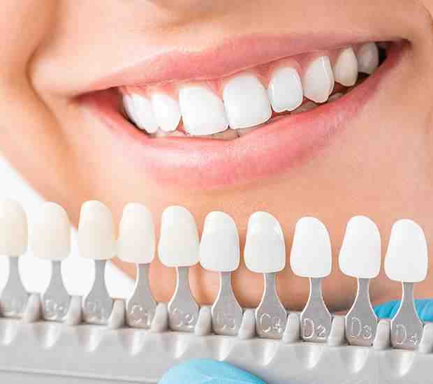 How Much Does a full dental makeover cost?