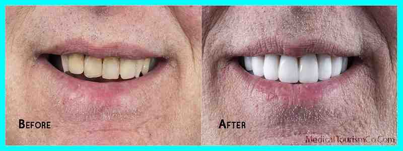 How can I practice dentistry in Italy?