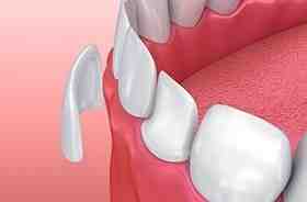How do I choose a cosmetic dentist?