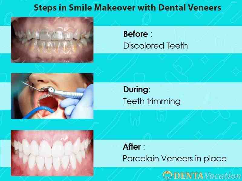 How do I choose a cosmetic dentist?