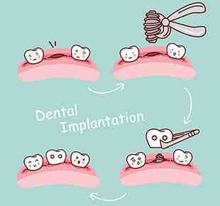 How do I choose a cosmetic dentist?