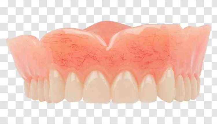 How much are dental implants at aspen dental