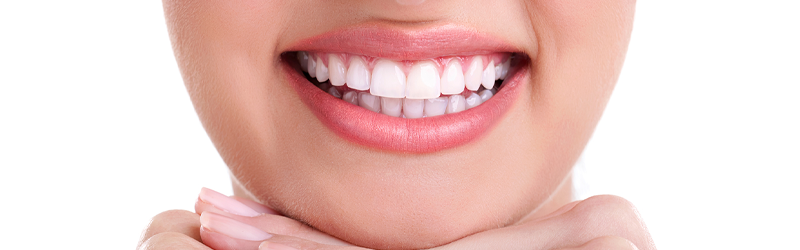 How much do cosmetic dental veneers cost?