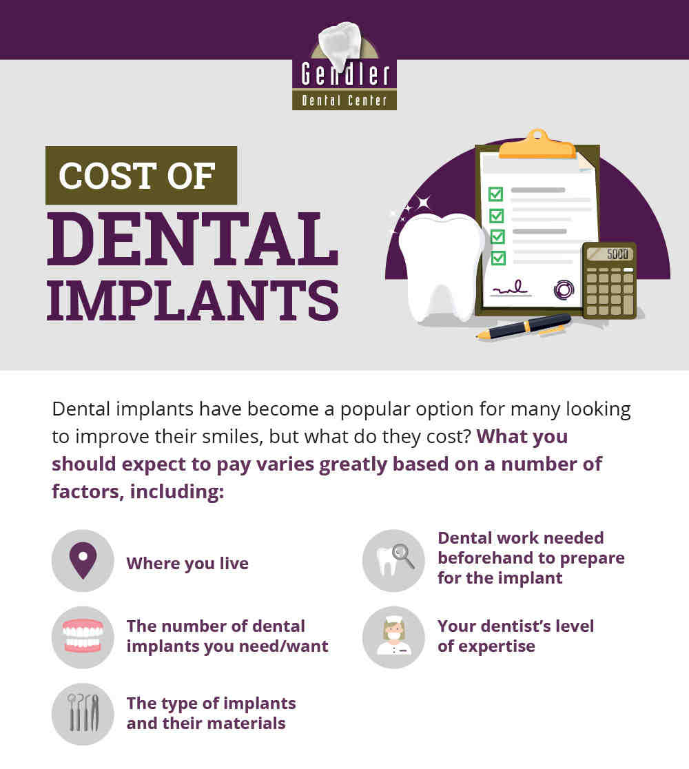How much do dental implants cost NZ?