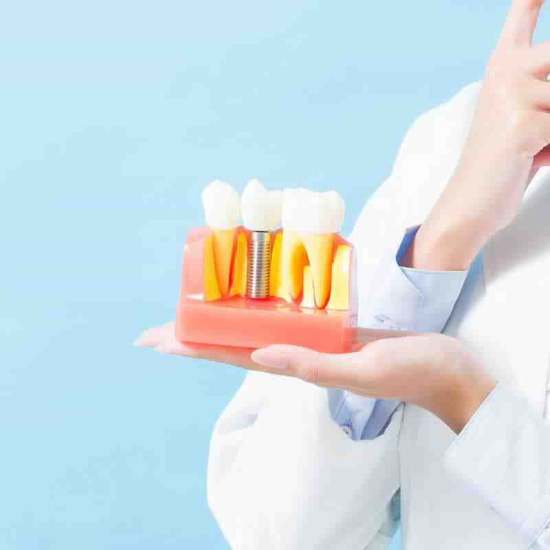 Does signature dental care in murrieta do all on 4 implant procedure Dental News Network