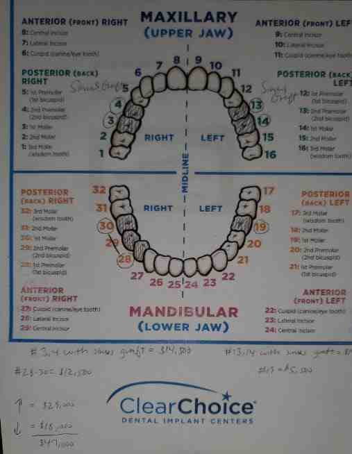 How much does ClearChoice cost?