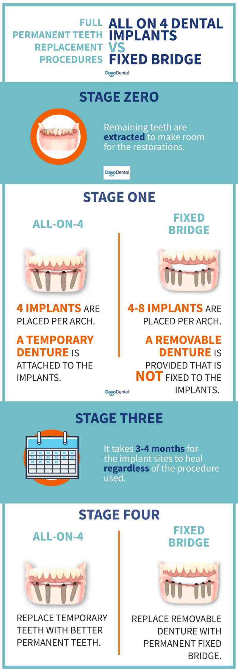 How much does a dental implant cost in canada - Dental News Network