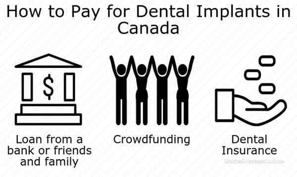 How much does a dental implant cost for one tooth?