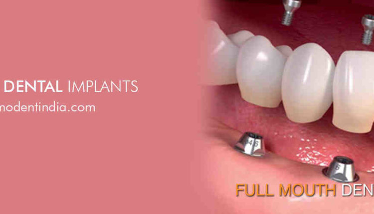 How much does a dental implant cost in nyc