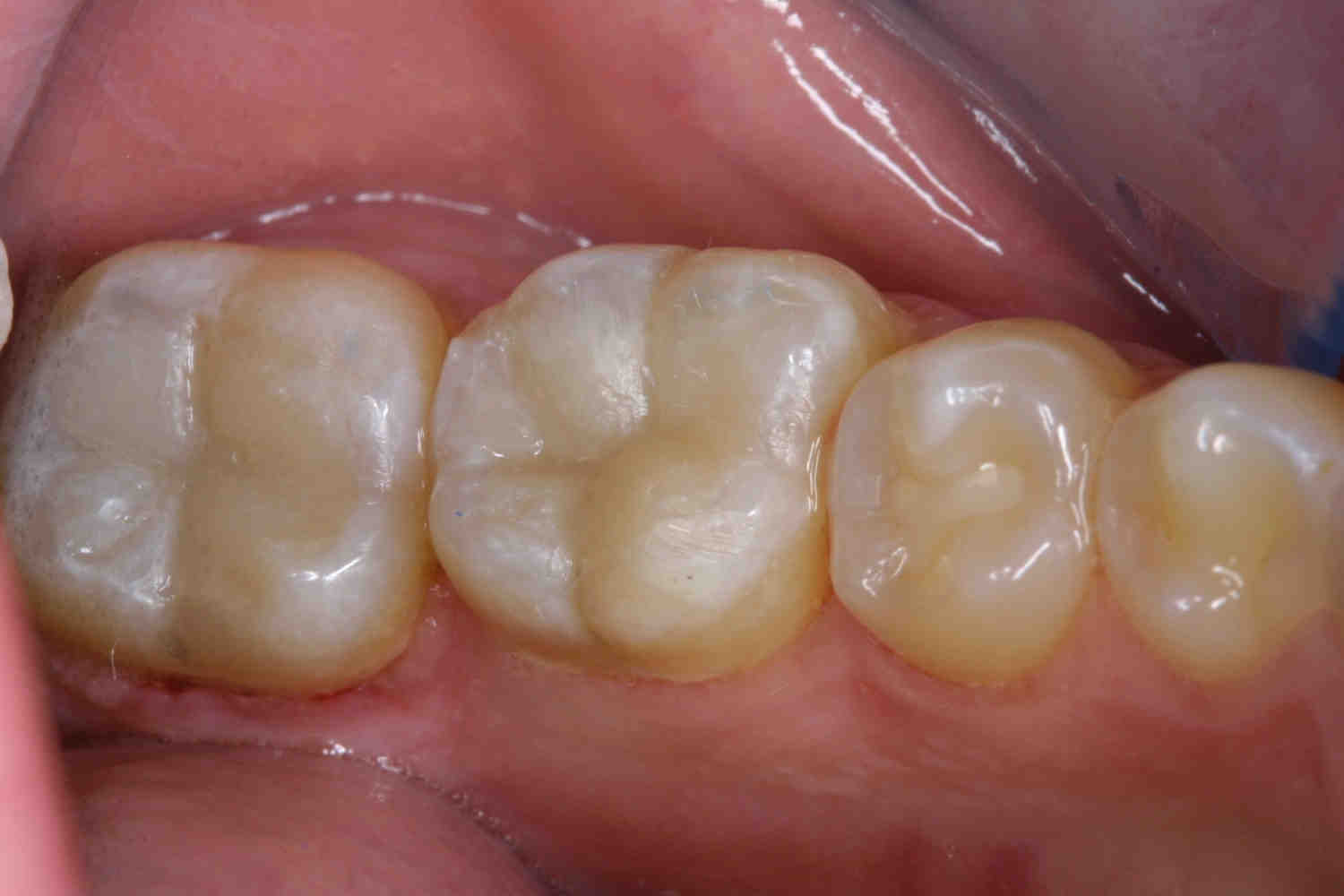 Cosmetic dentistry in columbia Dental News Network