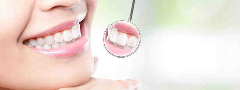 How much is a smile makeover in Mexico?