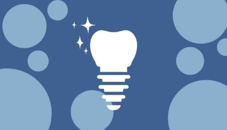 How to whiten dental implants