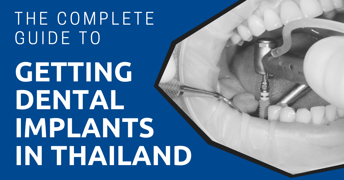 Is dental work cheaper in Thailand?