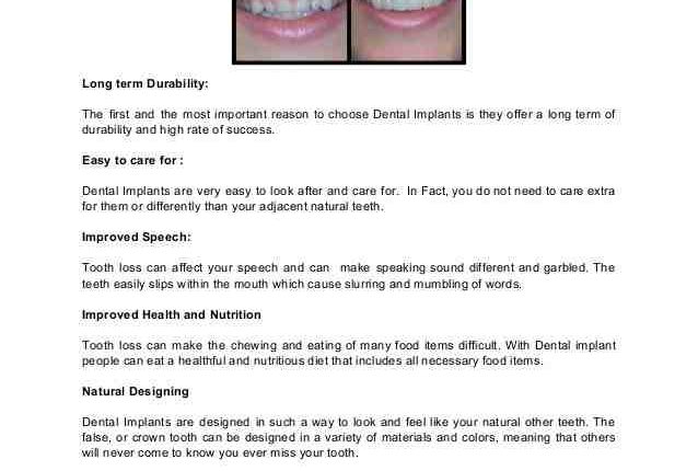 Is speech affected with dental implants