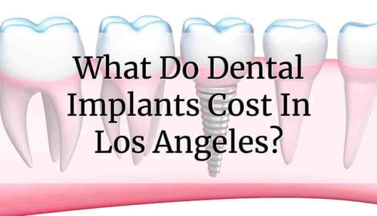 What do dental implants cost?