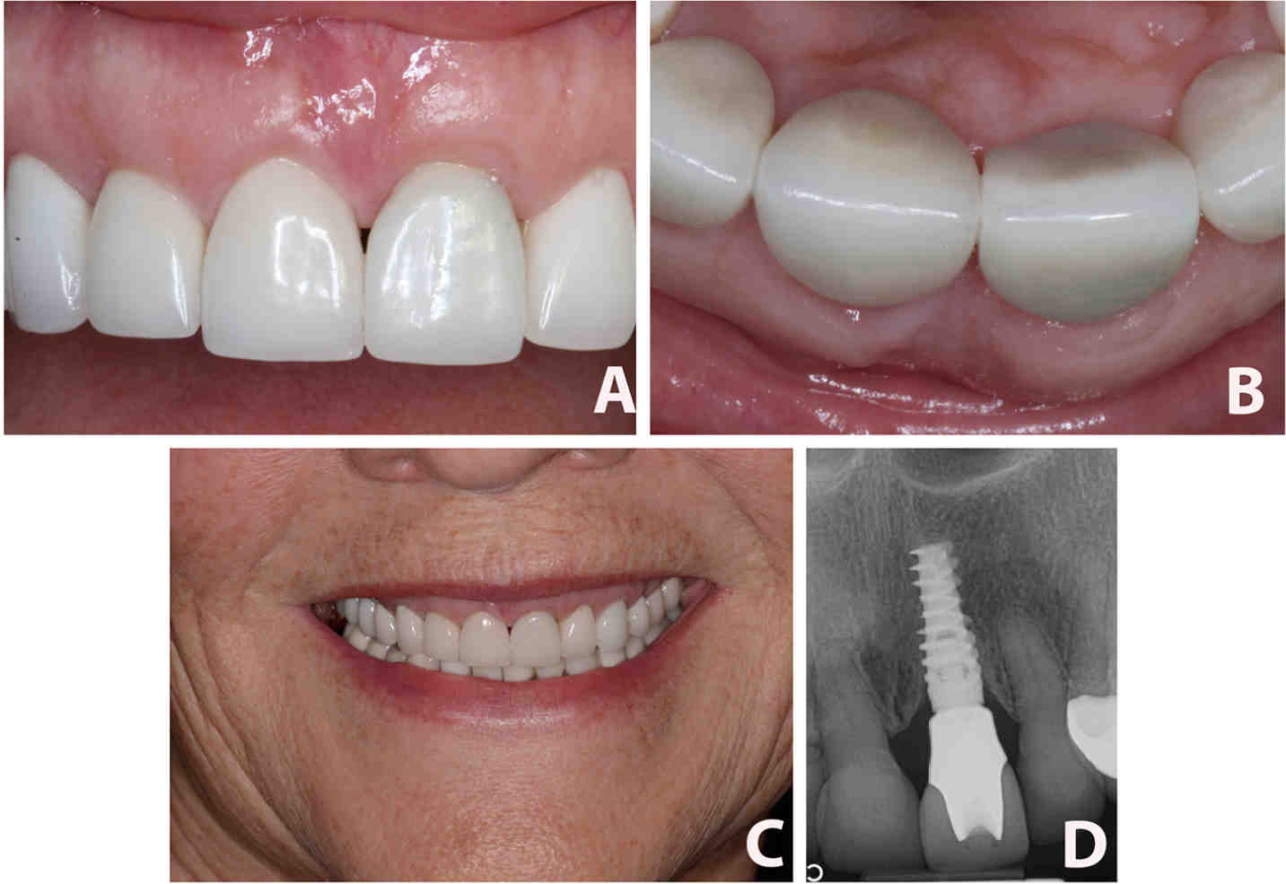 Cosmetic dentistry keywords Dental News Network