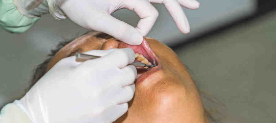 What happens if you don't get an implant after tooth extraction?