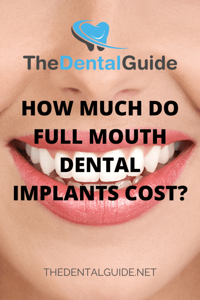 What is a reasonable price for dental implants?
