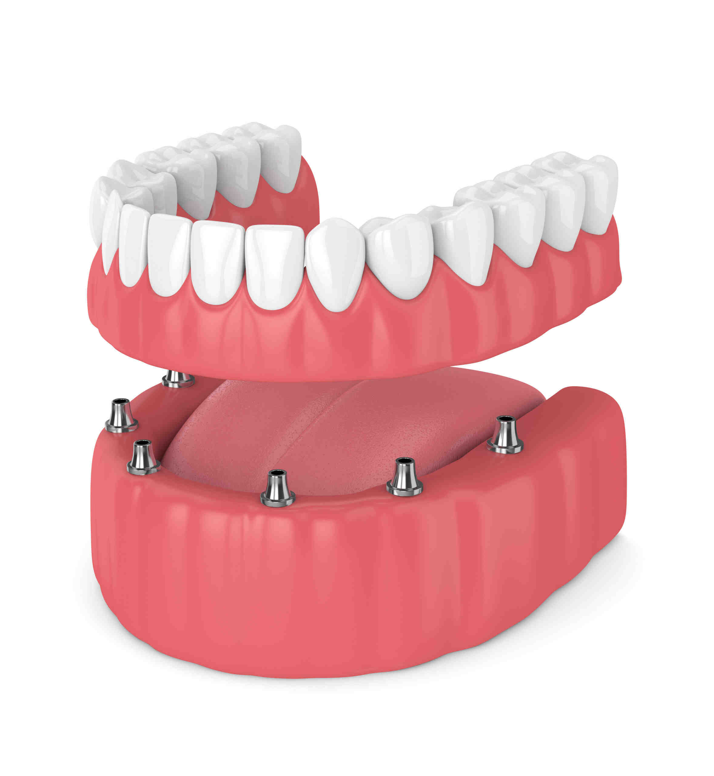What is considered medically necessary dental work?