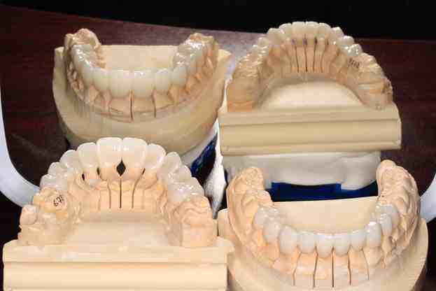 What is considered non cosmetic dentistry?