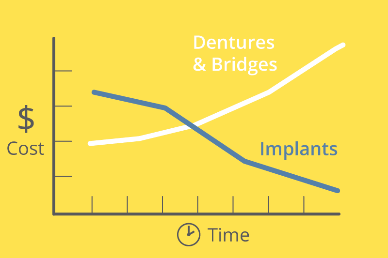 What is the average cost of full dental implants?