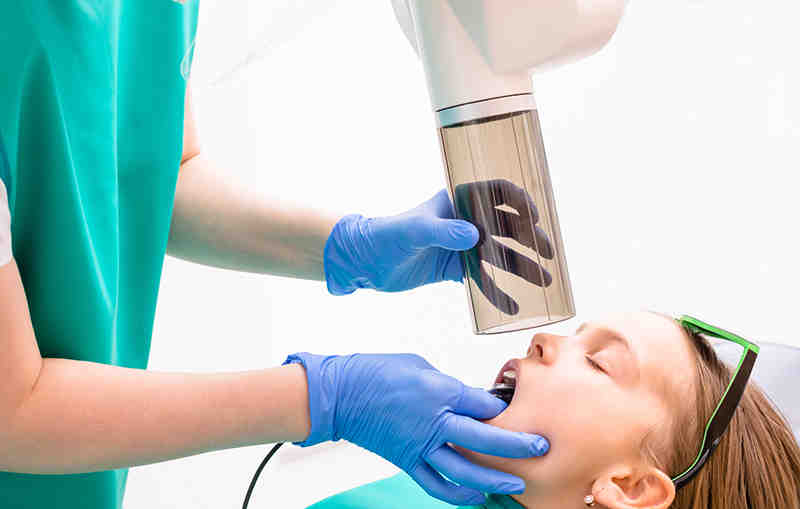 What is the average price for a full set of veneers?