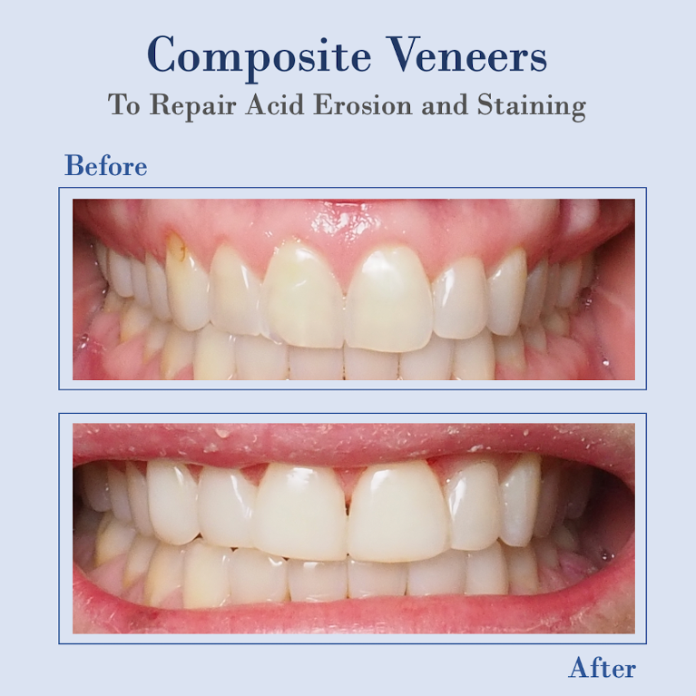 What is the best cosmetic dentistry?