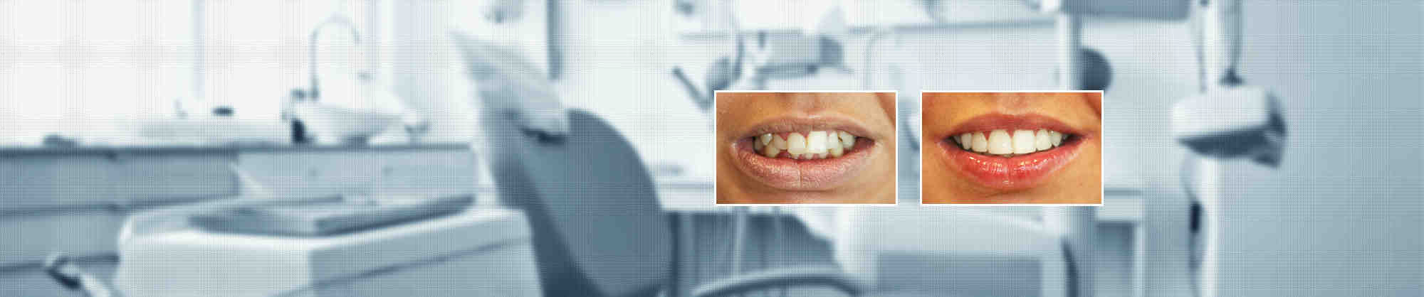 Cosmetic dentistry keywords - Dental News Network