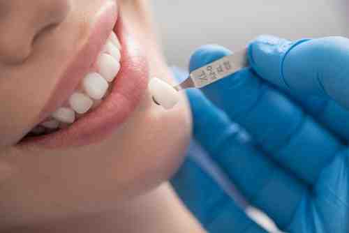 What is the best cosmetic dentistry?