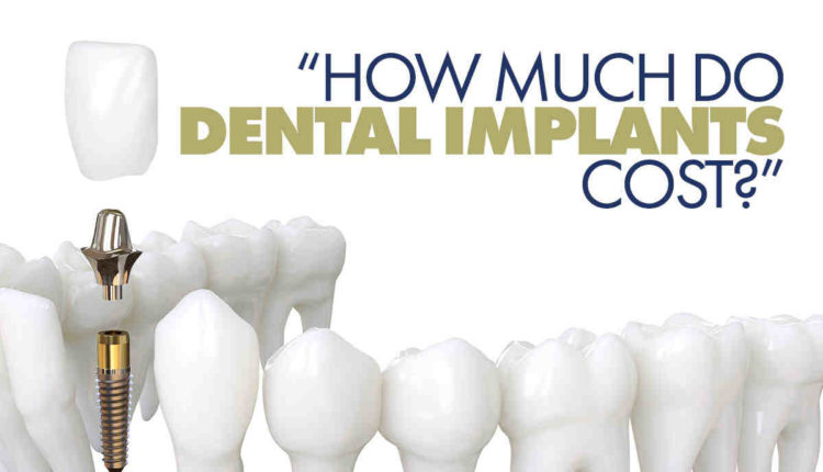 What is the cost for dental implants