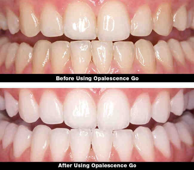 What is the difference between cosmetic dentistry and general dentistry?