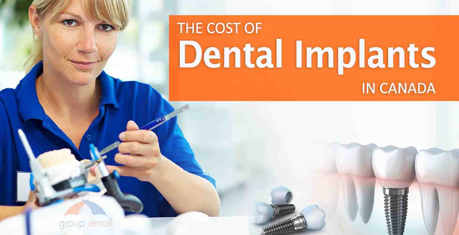 What is the downside of dental implants?