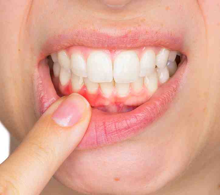 What are the symptoms of dental implant failure? Dental News Network