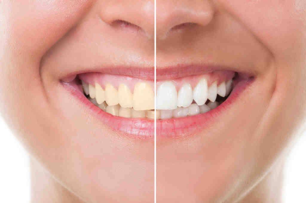 When should I see a cosmetic dentist?