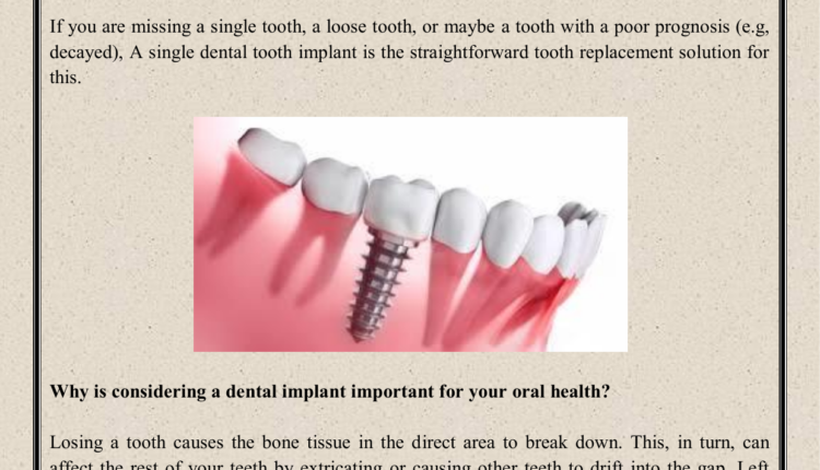 Who does a dental implant