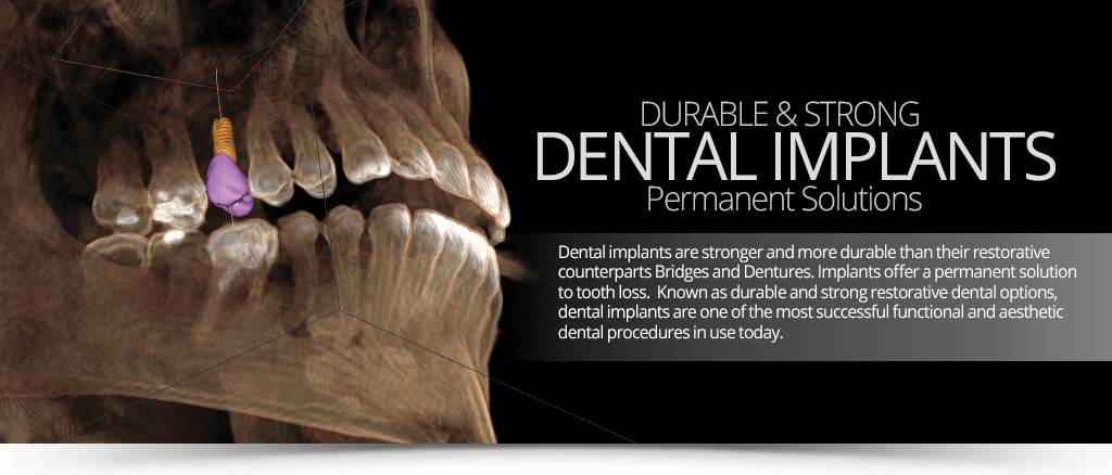 Are implants as strong as natural teeth?