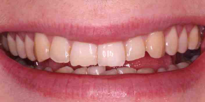 Can I pay my dentist in installments?