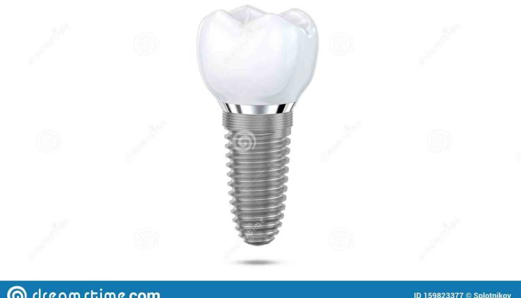Can air get into dental implant