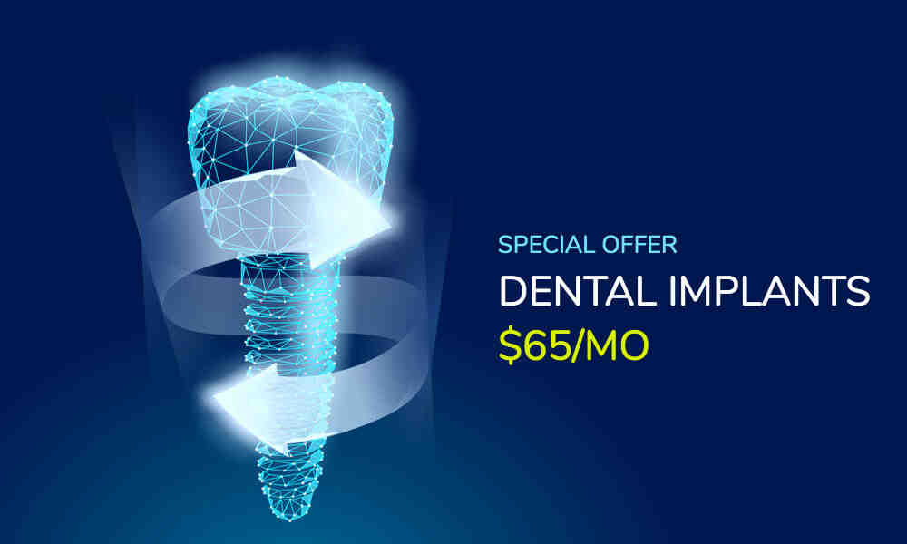 Can you floss around implants?
