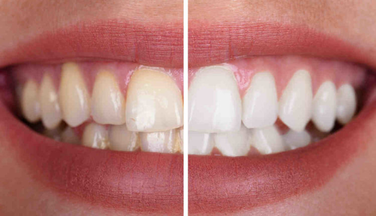 Cosmetic dentistry oregon near me