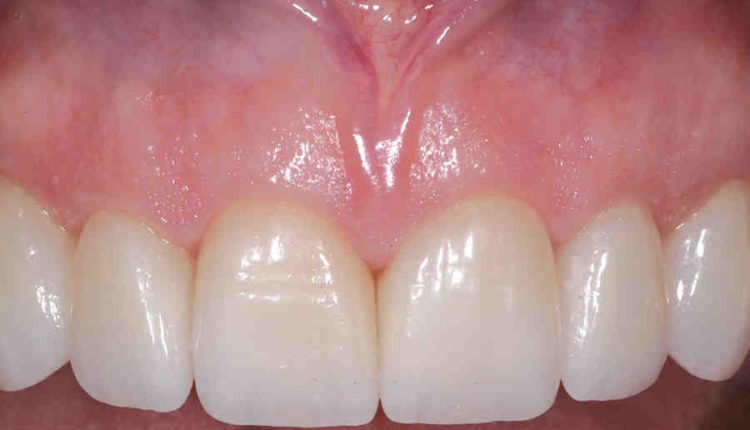 Cosmetic dentistry outline