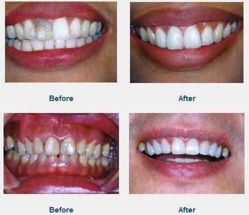 Cosmetic dentistry procedures by state