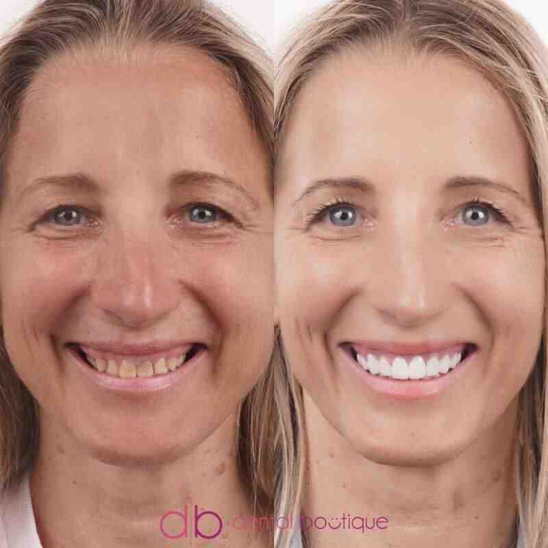 Cosmetic dentistry payment plans near me Dental News Network