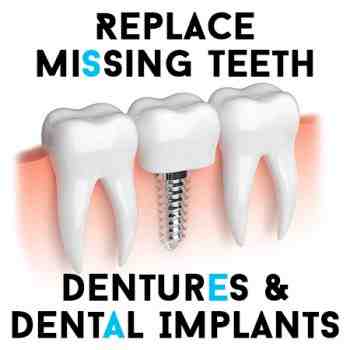 Do dental implants ever have to be removed?