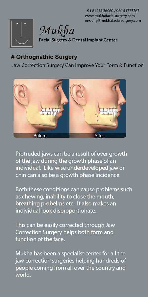 Does losing back teeth change your face?