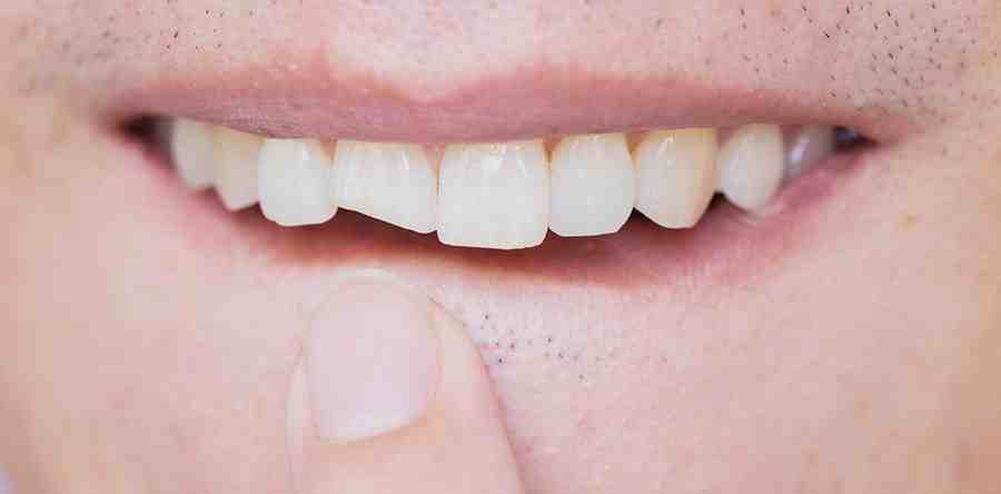 How do you find a good cosmetic dentist?