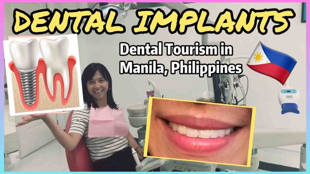 How expensive is dental implants Dental News Network