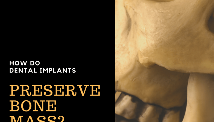 How much bone is needed for a dental implant