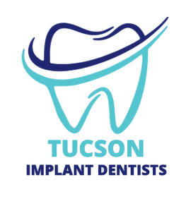 How much do dental implants cost in Arizona?