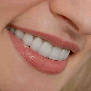 How much does a cosmetic smile cost?